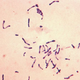 Illustration for article titled Diphtheria Excited About Possibility Of New Outbreak